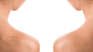 Healing from Within: Strategies to Eradicate Internal Scar Tissues ...